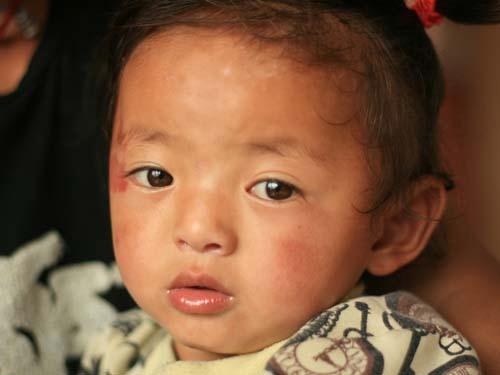 【我们要做什么】髋关节手术平均一个孩子需要大约五万多元的治疗费用,对于这8个经济贫困的家庭来说,无异于天文数字。我们将募集到的善款用于救助藏区8个经济贫困家庭的先天性髋关节脱位儿童,帮助他们赴上海就医,恢复健康。